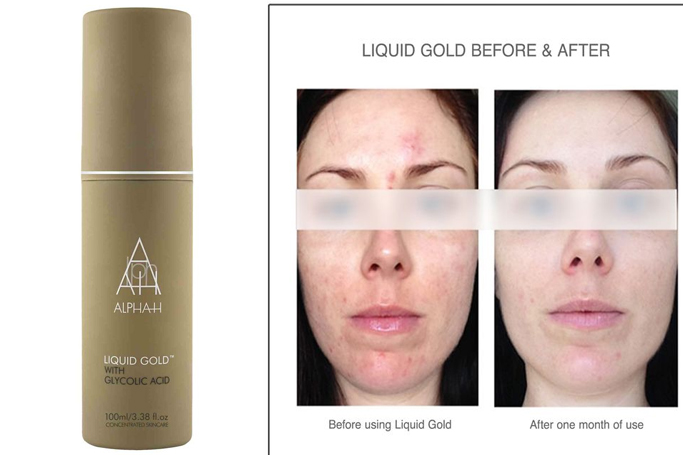 Alpha-H - Liquid Gold Alpha-H - Liquid Gold